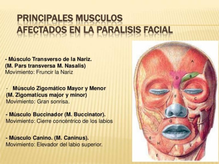 Puntos Motores De La Cara En Paralisis Facial saludymedicina.org
