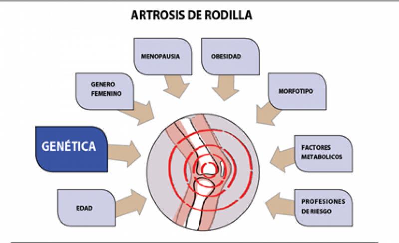 La obesidad como factor de riesgo en la artrosis de rodilla