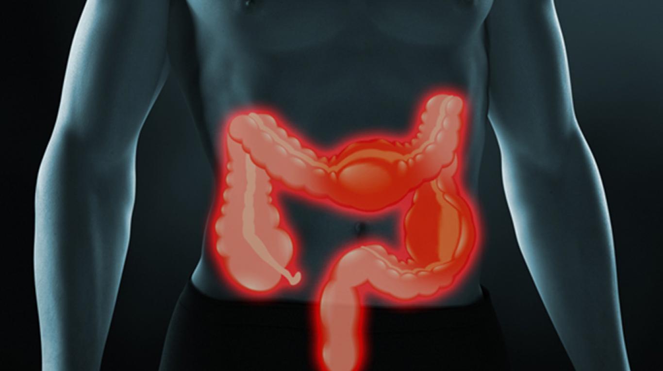 Detectar Y Tratar A Tiempo La Enfermedad De Crohn Es Fundamental Salud Y Medicina