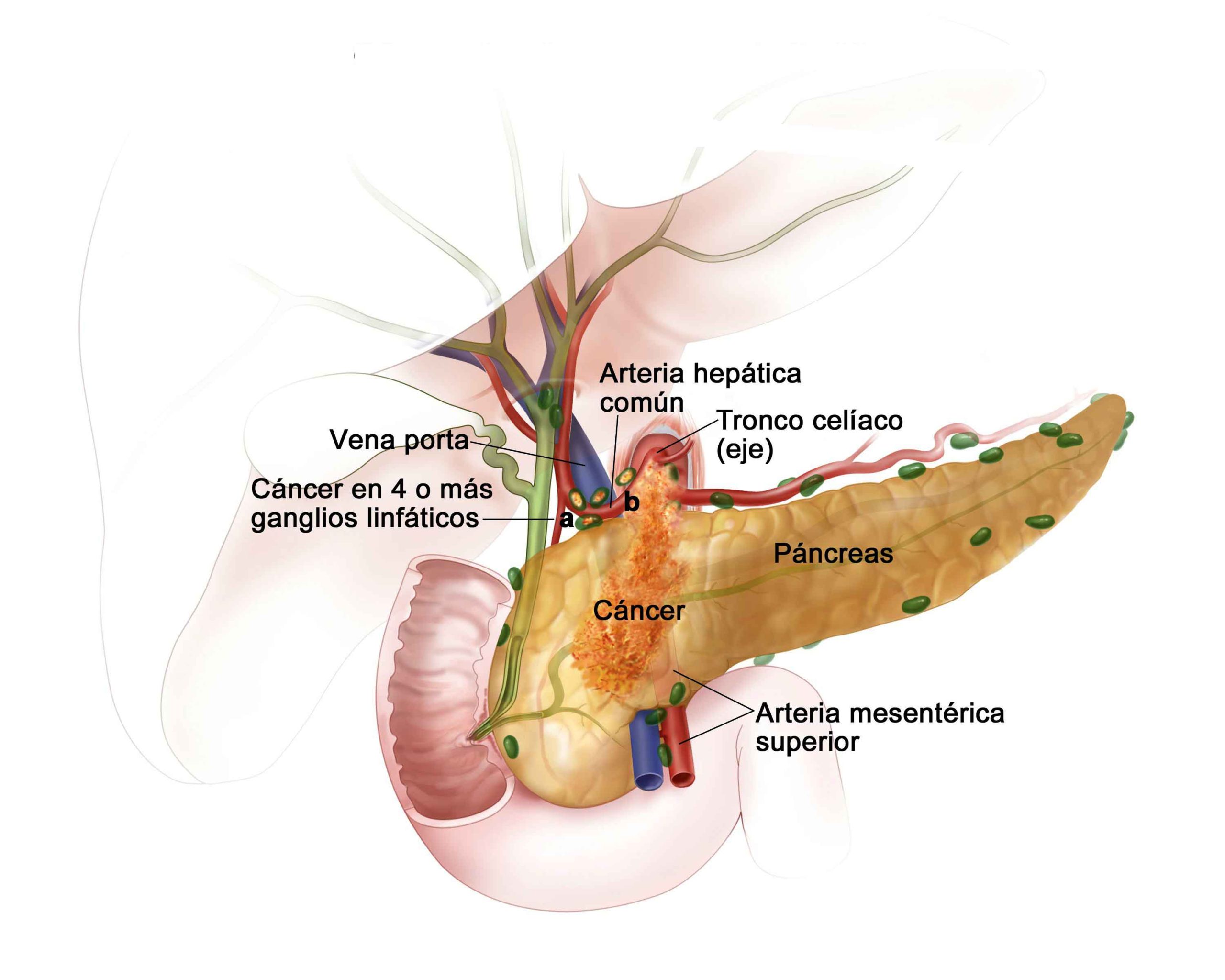 they-identify-a-key-gene-in-the-development-and-treatment-of-the-most